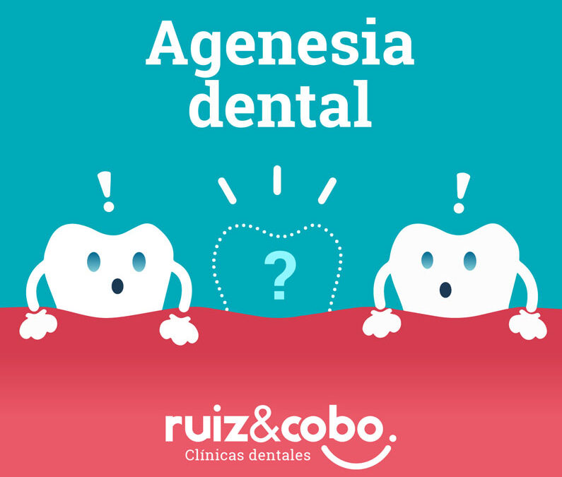 Agenesia dental