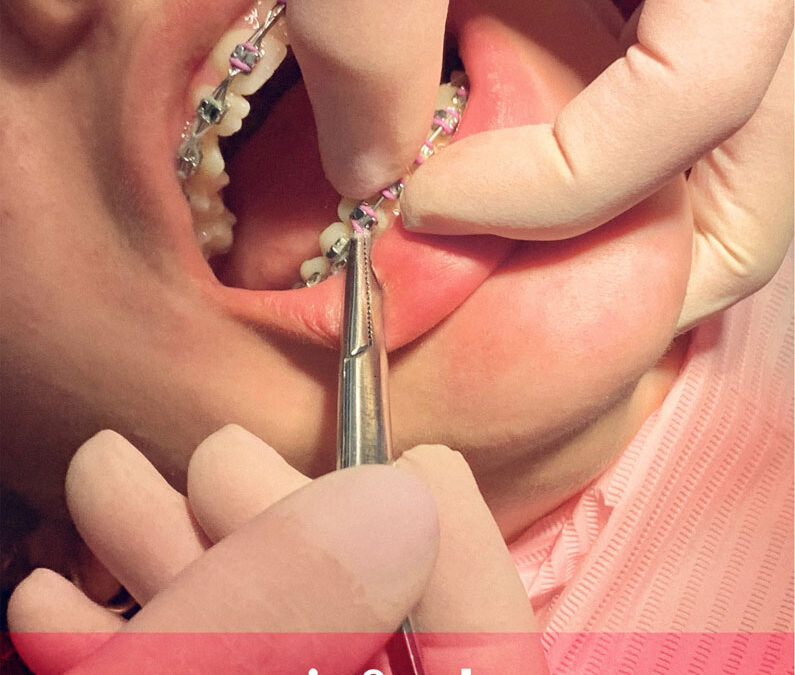 ¿Como debe ser una ortodoncia?